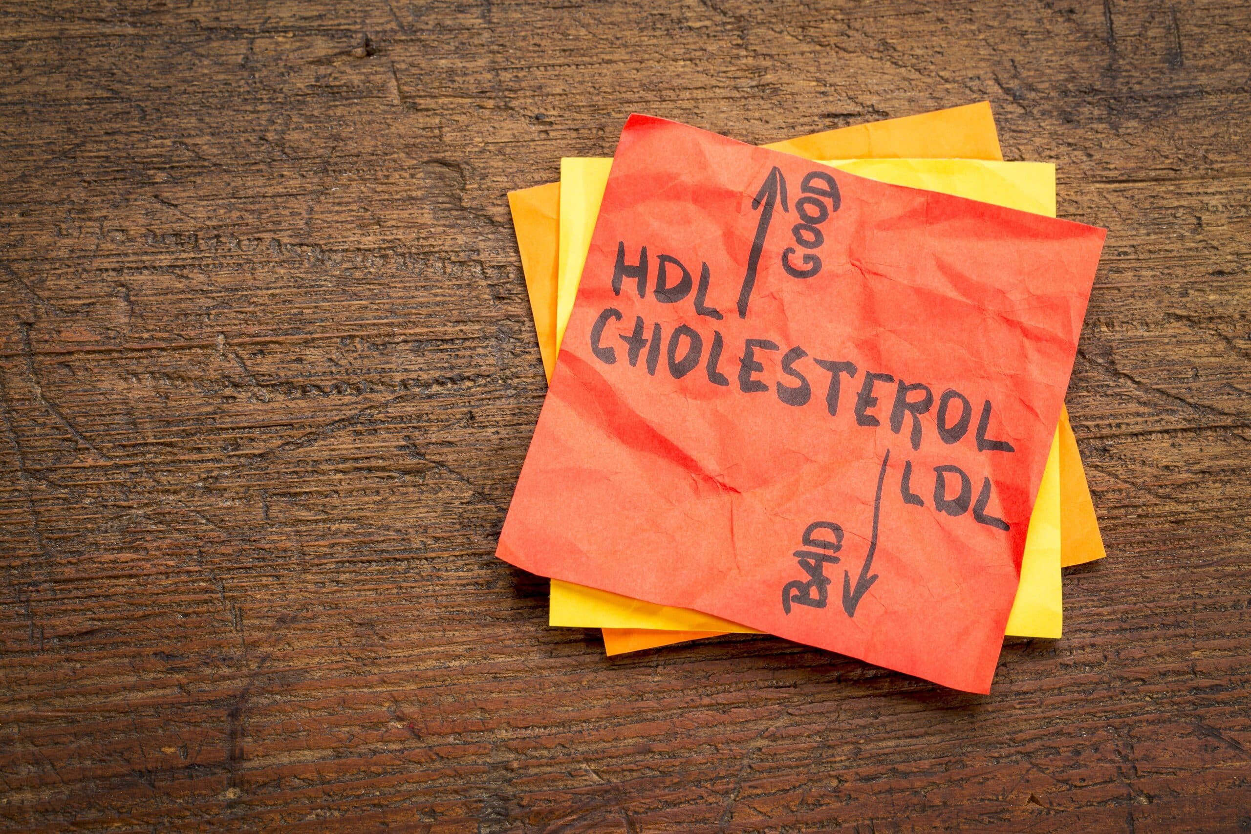 sepmed warszawa niepubliczny zaklad opieki zdrowotnej Cholesterol